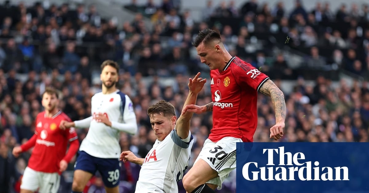 塞斯科膝伤缺席斯洛文尼亚赛事 曼联盼国际赛后回归